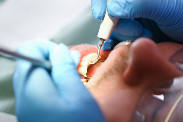 Best Pediatric Emergency Dentist in Sunrise, FL