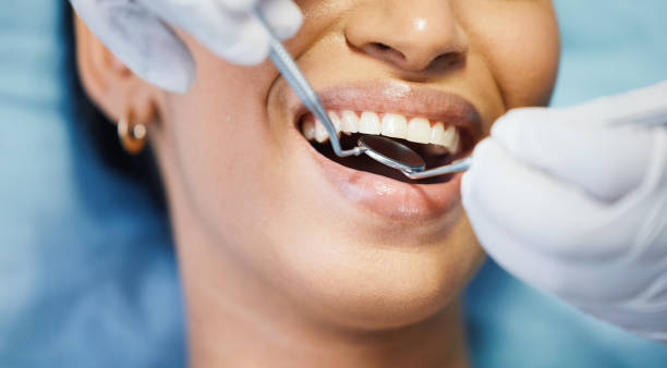 Best Emergency Treatment for Dental Infections or Abscesses in Sunrise, FL
